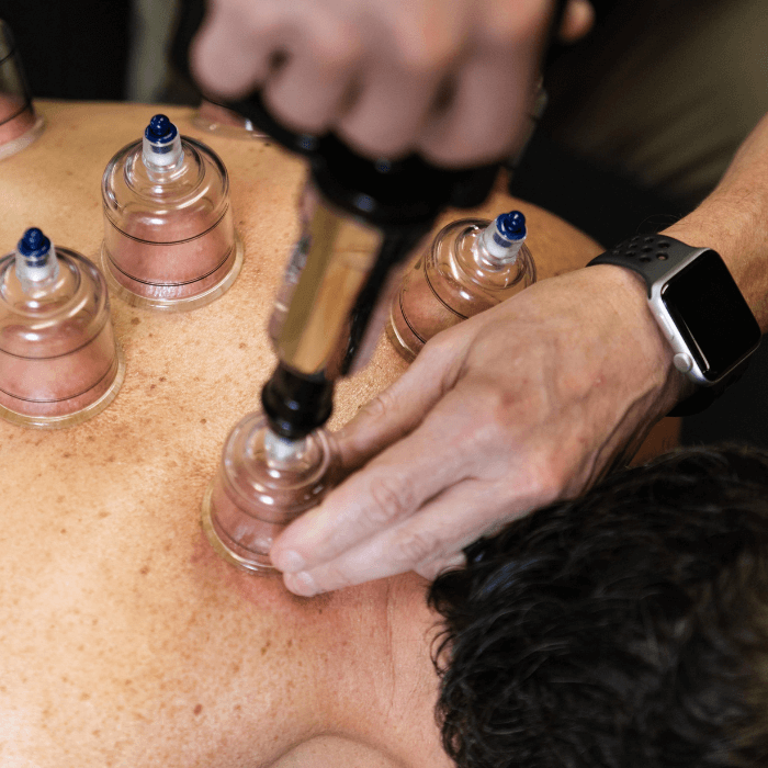 Patient undergoing Cupping treatment at Launch Physical Therapy in Phoenix Arizona